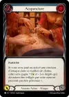 Product image for Acuponcture